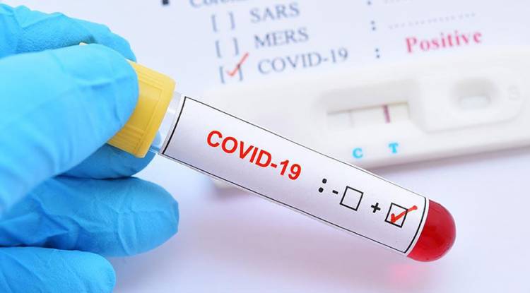 राज्यमन्त्रीका स्वकीय सचिव र चालकमा कोरोना संक्रमण