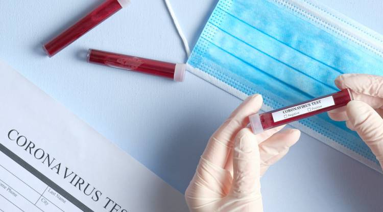 प्युठानमा एकैदिन ९ जनामा कोरोना पुष्टि, संक्रमित संख्या ३३ पुग्यो