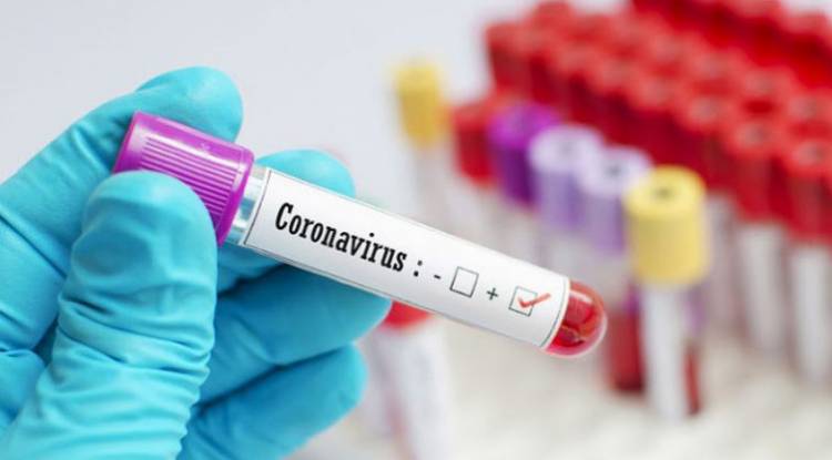 गुल्मीमा थप ३ जनामा कोरोना संक्रमण पुष्टि