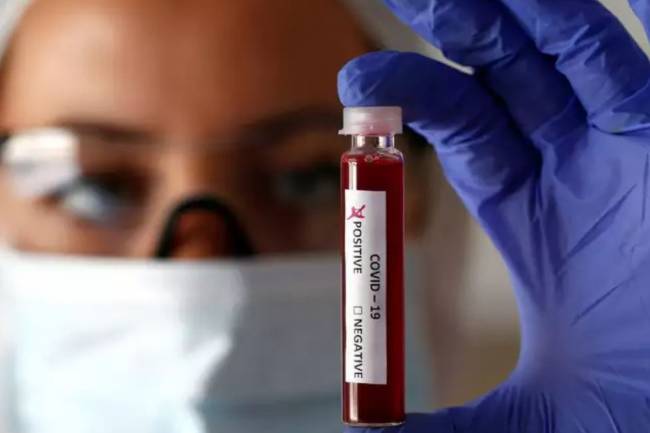 कोरोना संक्रमित एकैदिनमा थपिए अहिलेसम्मकै बढी, पुगे १२ सय १२