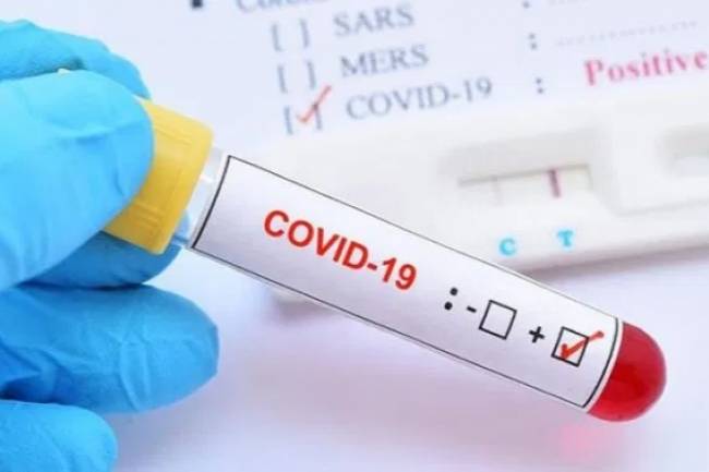 प्यूठानमा थप २० जनामा कोरोना पुष्टि,संक्रमित संख्या २११ पुग्यो