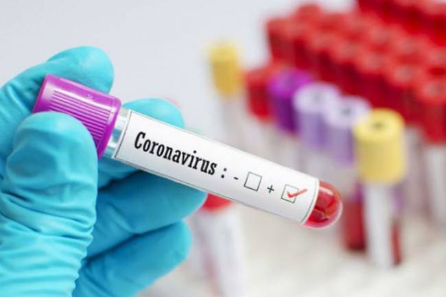 कोरोना :प्यूठानमा कुल संक्रमित ३०४ , निको हुने २५ पुगे