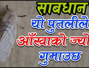 आँखाको ज्योतिनै गुम्न सक्ने रोग लाग्ने बत्तिमा घुम्ने सेतो पुतली बढ्दो 